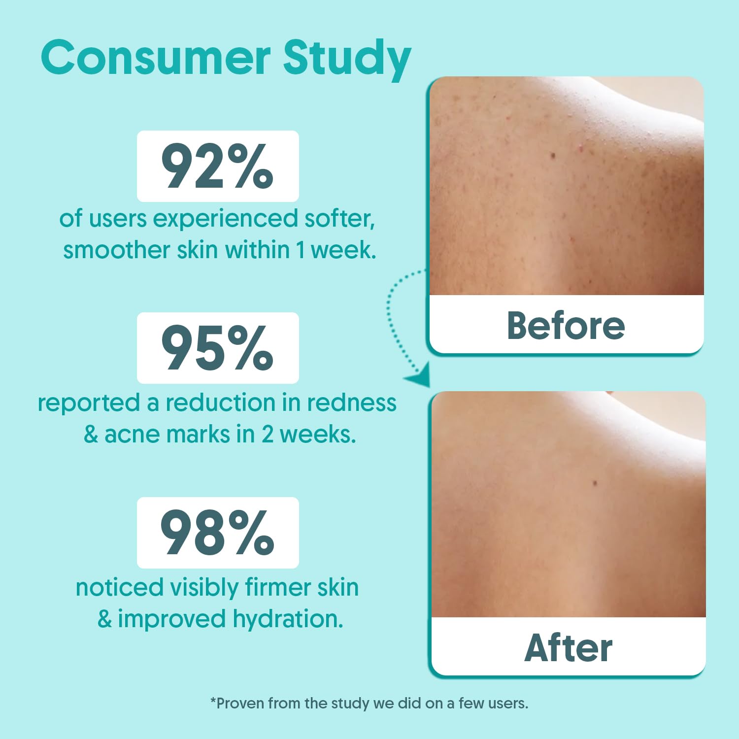 Aravi Organic 2% Salicylic Acid Exfoliating Body Wash with Niacinamide & Blueberry - Prevents Body Acne, Dead Cells, Deep Cleanses & Odor Defense - All Skin Types - SLS & Paraben Free - 300 ml
